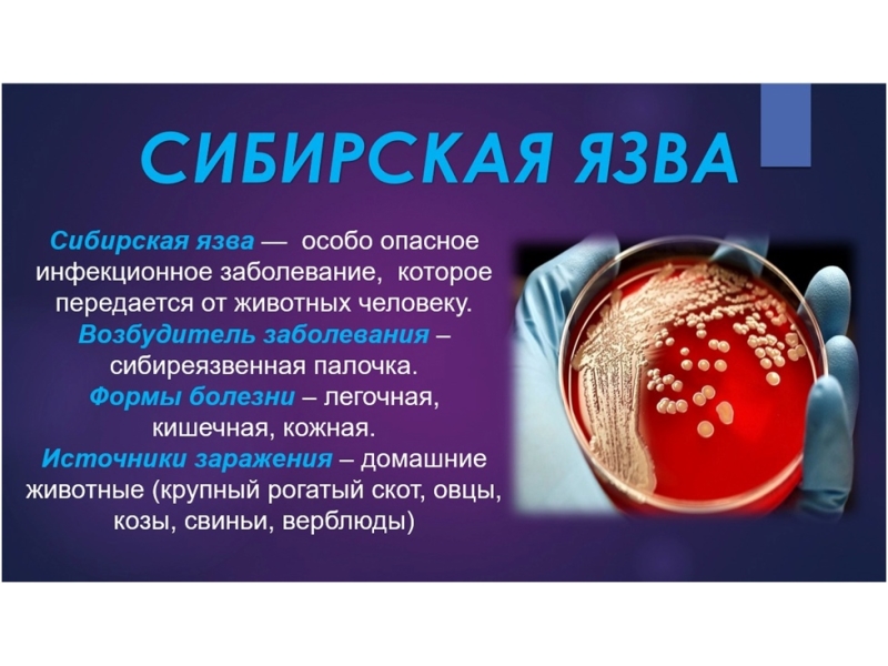 Сибирская язва..